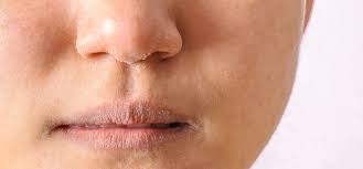 12 Top Tips to Beat the Winter Skin Blues
